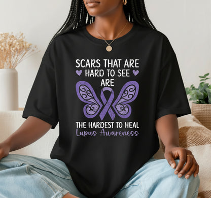 LOVE HOPE LUPUS AWARENESS FIGHT FOR A CURE – Lupus Awareness DTF Transfer
